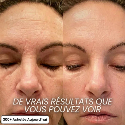 Baume PDRN & Collagène Rose