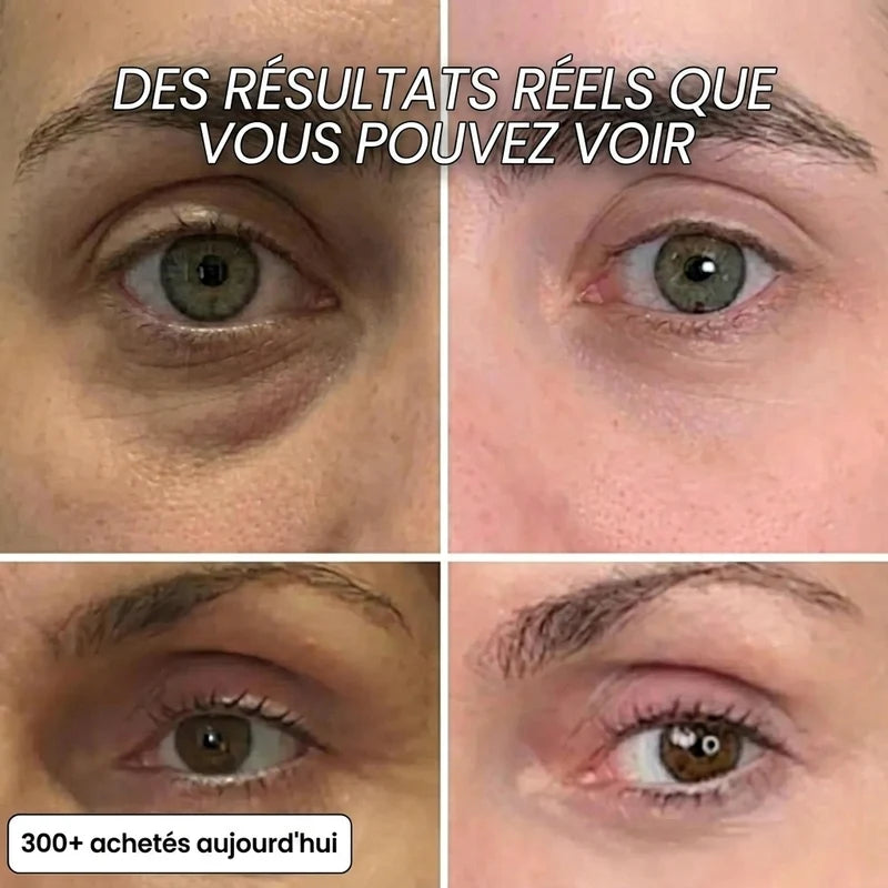 Baume PDRN & Collagène Rose